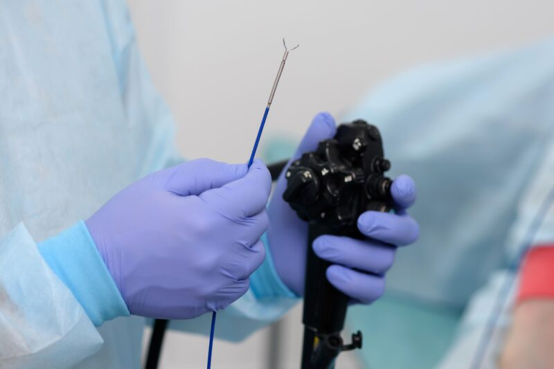 胃カメラと大腸カメラ検査のイメージ